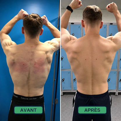 Correcteur de Posture Instantané